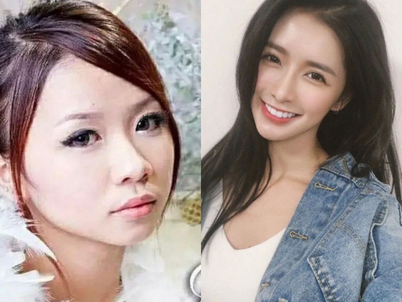 整形的明星盘点（10位明星因整容走向人生巅峰）