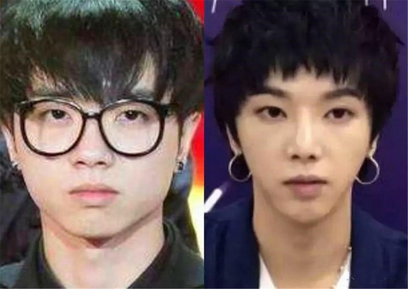 整形的明星盘点（10位明星因整容走向人生巅峰）