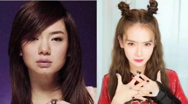 整形的明星盘点（10位明星因整容走向人生巅峰）