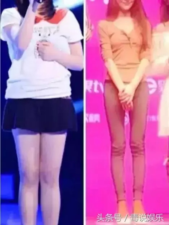 徐海星长什么样（徐海星整容前后照片对比）