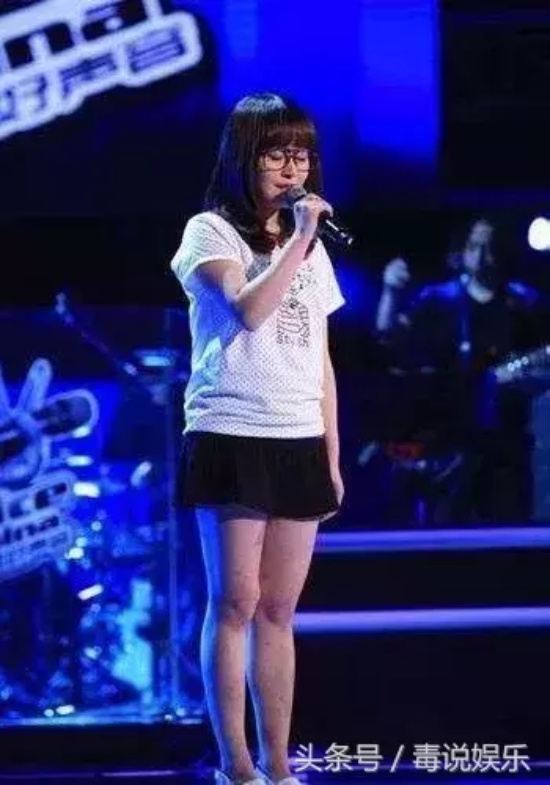 徐海星长什么样（徐海星整容前后照片对比）