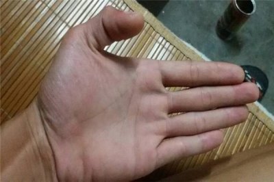 ​凤眼纹大和小的区别 凤眼纹很小算吗