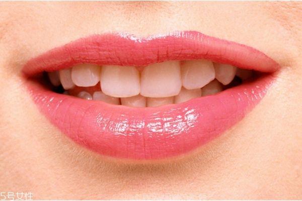 嘴唇干燥怎么办 护唇小贴士 嘴唇干燥怎么办 护唇小贴士