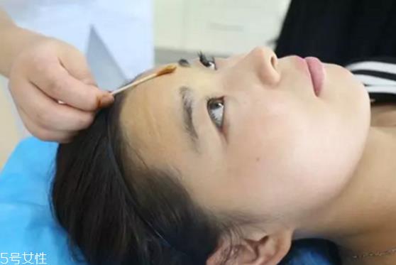 有抬头纹怎么办 如何去除抬头纹