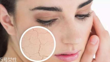 干皮怎么防晒最有效 3步就搞定干皮防晒