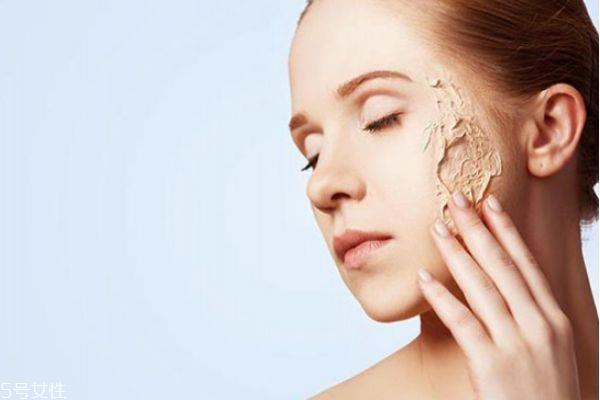 干皮会出油吗 干皮为什么脸上会出油 干皮会出油吗 干皮为什么脸上会出油