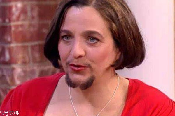 脱毛膏可以用在脸上吗 脱唇毛小窍门