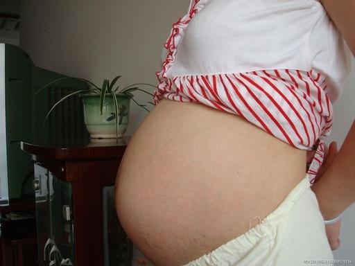 妊娠纹怎样能消除