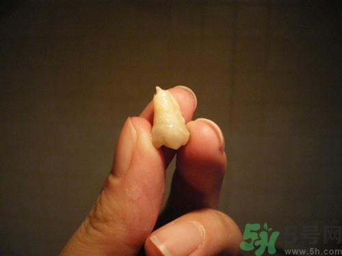 拔智齿能瘦脸吗?拔智齿后注意事项