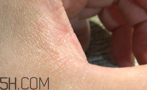 雅顿金胶适合什么肤质？雅顿金胶适合油皮和混油皮吗？