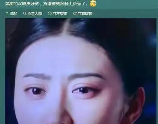 景甜自爆整容失败,大欧式双眼皮撞脸悲伤蛙,情绪一度懊悔抑郁