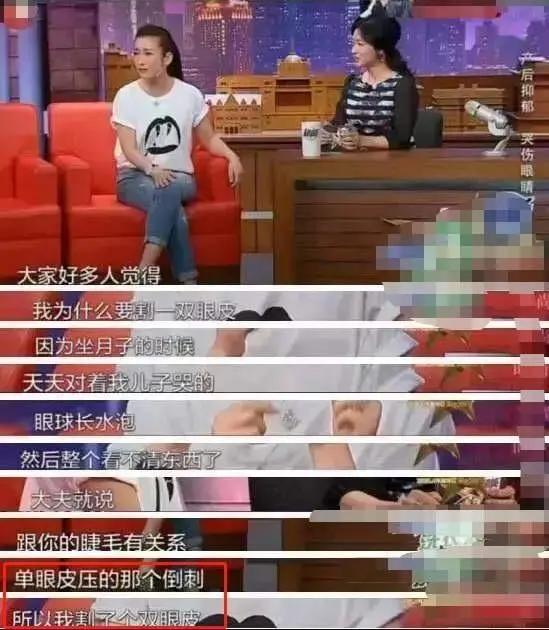 景甜自爆整容失败,大欧式双眼皮撞脸悲伤蛙,情绪一度懊悔抑郁