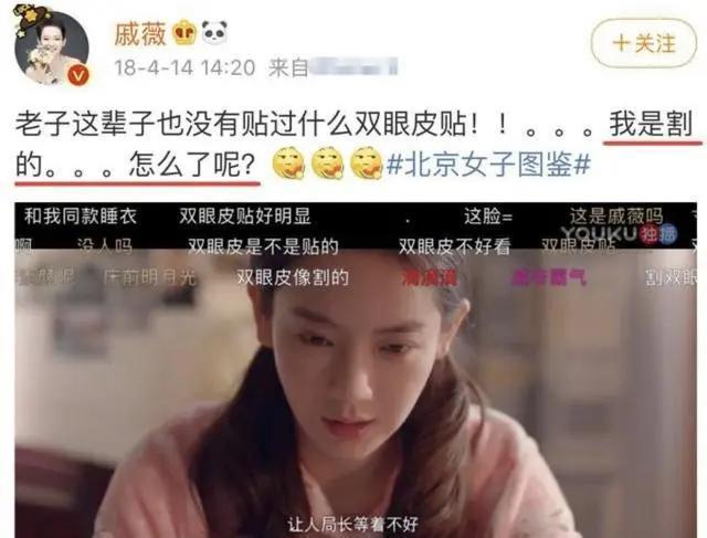 景甜自爆整容失败,大欧式双眼皮撞脸悲伤蛙,情绪一度懊悔抑郁