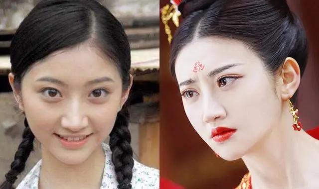 景甜自爆整容失败,大欧式双眼皮撞脸悲伤蛙,情绪一度懊悔抑郁