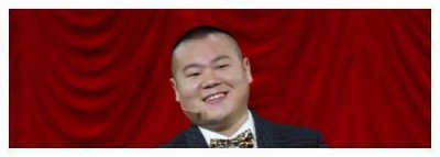 ​岳云鹏被曝和辣妹酒店过夜，网友：尽显男儿本“色”