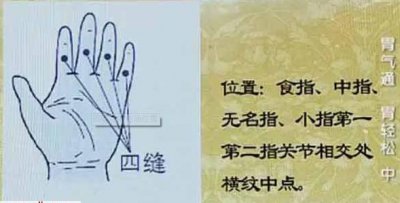 ​[针灸]“扎四缝”的妙用