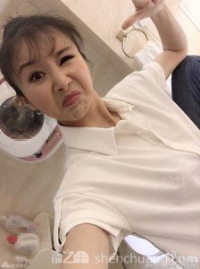 ​孙菲菲晒照破整容失败传闻 孙菲菲整容前后对比