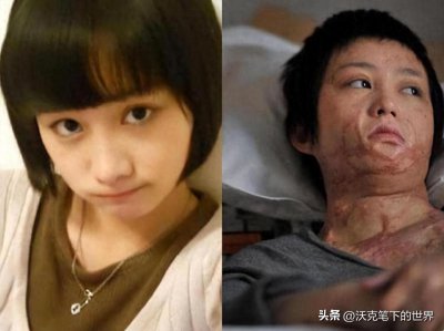 ​12年过去了，拒绝同学求爱，被泼汽油毁容的周岩，过得还好吗？