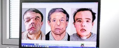 ​《画皮》再现，法国男子两次换脸成为世界上唯一有过三张面孔的人