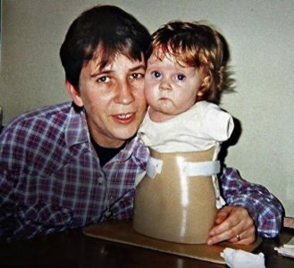 ​图看英国版“人彘”女孩：虽然不幸，但依旧快乐成长