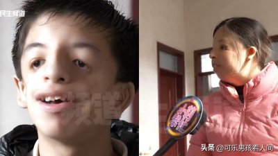 ​河南｢鸟面综合症｣患母讲述患儿经历网民痛斥：明知遗传还生子？