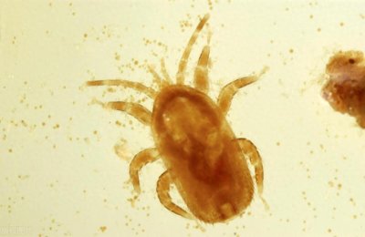 ​快速清除床上螨虫的几个妙招，让床上螨虫彻底消失，晚上睡香香！