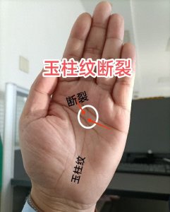 ​玉柱纹断裂之事业警示：命运转折期的洞察与防范