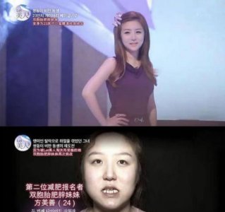 ​秋瓷炫整容前后（直击8位韩国丑女整容前后对比照）