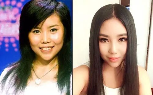 纪敏佳整容，歌手纪敏佳简介(纪敏佳个人资料简介)