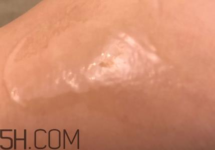 芳丹薄罗眼膜怎么用？芳丹薄罗眼膜要洗吗