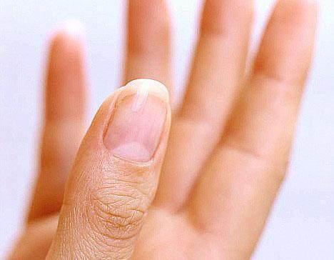 中医：成年人指甲长成这几种样子，说明你身体状态，真的出问题了